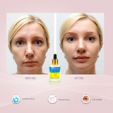 Double-Acting Facial Serum Whitening Based Whitening & Brightening