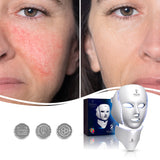 X8 Multi-Purpose LED PHOTON Skincare Mask | Non-Surgical Solution LED Treatment