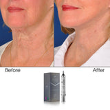 Age-Defying Stem Cell Chest & Neck Cream 10 GM - Secret Collagen