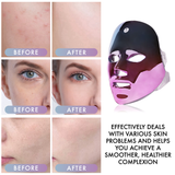 Flawless Face LED Mask | Multi-Purpose Skin Care LED Mask | Cordless New Generation