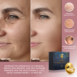 2 in 1 Prestige Skin Care Gold Mask | Oxygen & Cell Renewal Masks | Pack of 16